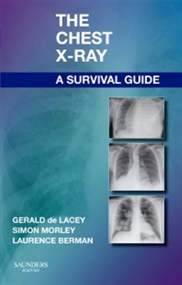 Knjiga Chest X-Ray: A Survival Guide autora Gerald de Lacey , Simon Morley izdana 2008 kao meki uvez dostupna u Knjižari Znanje.