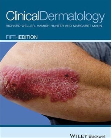 Knjiga Clinical Dermatology 5E autora Richard B. Weller, Hamish J. A. Hunter, Margaret W. Mann izdana 2015 kao meki uvez dostupna u Knjižari Znanje.