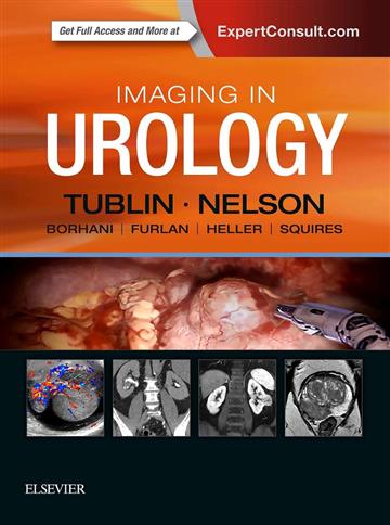 Knjiga Imaging in Urology autora Mitchell E. Tublin, Joel B. Nelson izdana 2018 kao tvrdi uvez dostupna u Knjižari Znanje.