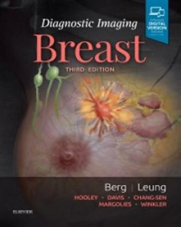 Knjiga Diagnostic Imaging: Breast 3E autora Wendie A. Berg , Jessica Leung izdana 2019 kao tvrdi uvez dostupna u Knjižari Znanje.