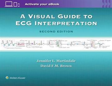Knjiga A Visual Guide To ECG Interpretation 2E autora Jennifer L. Martindale, David F.M. Brown izdana 2016 kao meki uvez dostupna u Knjižari Znanje.