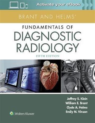 Knjiga Brant and Helms' Fundamentals of Diagnos autora Jeffrey Klein, Emily N. Vinson, William E. Brant, Clyde A. Helms izdana 2018 kao tvrdi uvez dostupna u Knjižari Znanje.