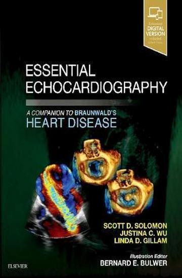Knjiga Essential Echocardiography: A Companion to Braunwald's Heart Disease autora Scott Solomon, Justina Wu, Linda Gillam izdana 2018 kao meki uvez dostupna u Knjižari Znanje.
